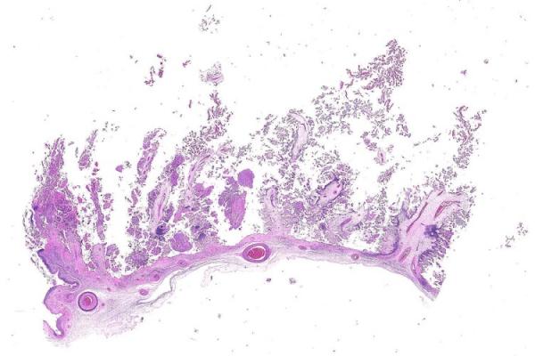 Mystery Case 2014 - 65468-3B