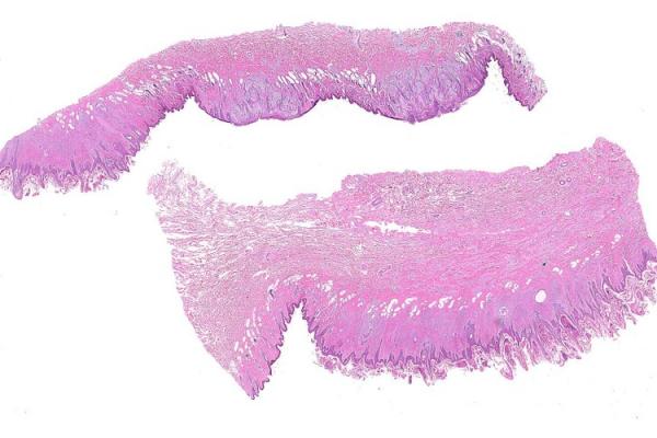 Mystery Case 2014 - 284