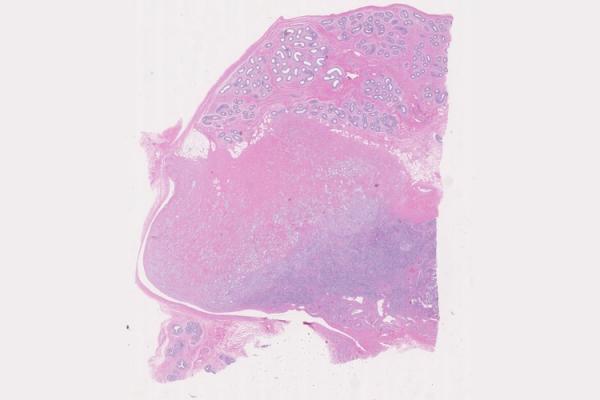 Mystery Case 2014 - FG-214A