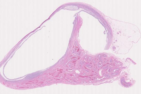 Mystery Case 2014 - FG-214B