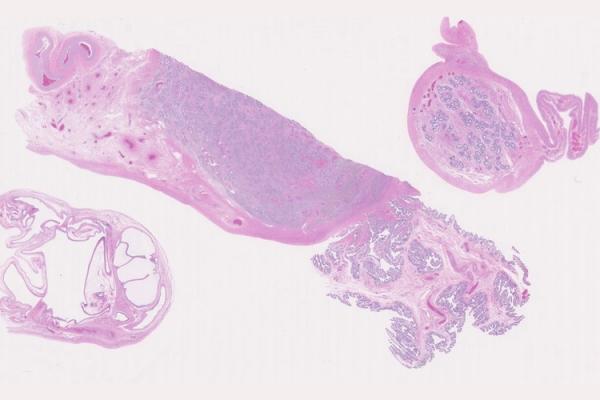 Mystery Case 2014 - FG-215A