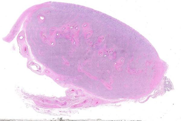 Mystery Case 2014 - FG-2B