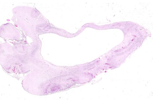 Mystery Case 2014 - FG82