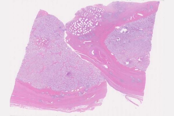 Mystery Case 2014 - MG-103