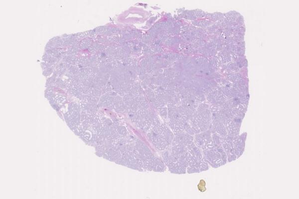 Mystery Case 2014 - MG-105 (T11-B021)